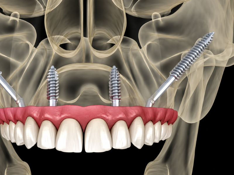 Child at dental clinic smiling